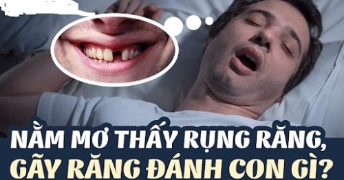 Nằm mơ thấy rụng răng đánh số mấy? Giấc mơ gãy răng giúp bạn phát tài
